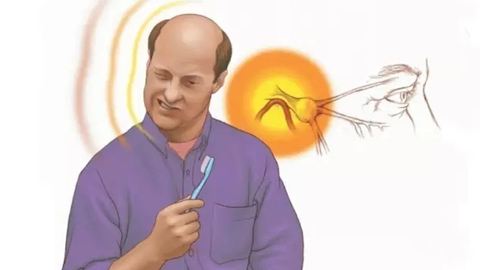 Trigeminal Neuralgia acupuncture mississauga