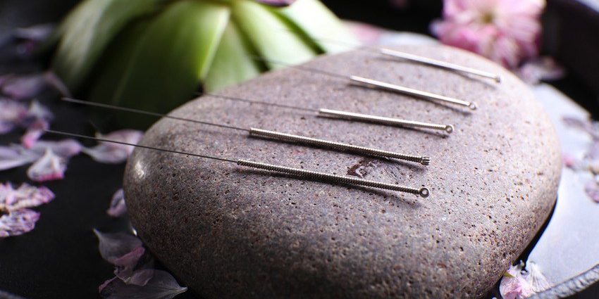 traditional Chinese acupuncture