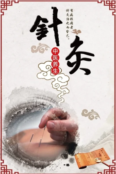 针灸密西沙加 密西沙加中医针灸治疗